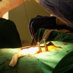 Minimally-Invasive-Spine-Surgery